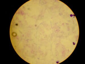 Plasmodium