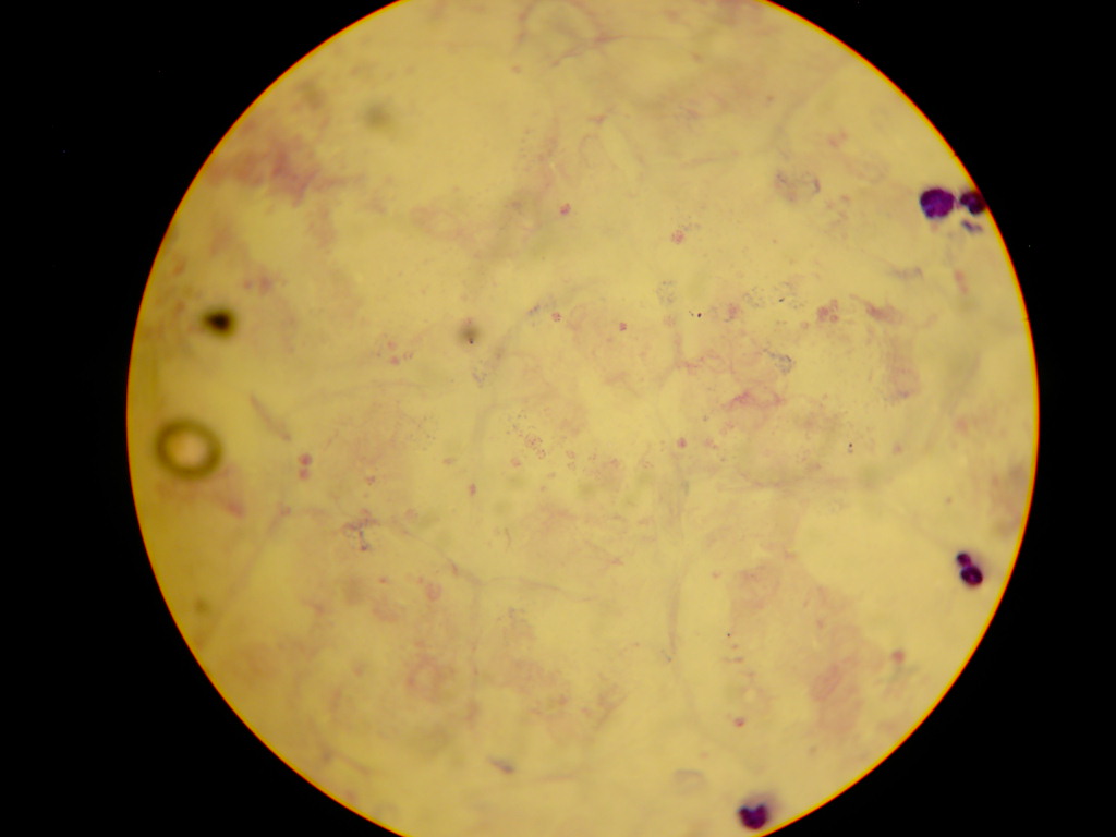 Plasmodium (Plasmodium falciparum)