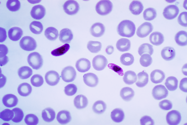 Plasmodium falciparum dentro de glóbulos rojos humanos