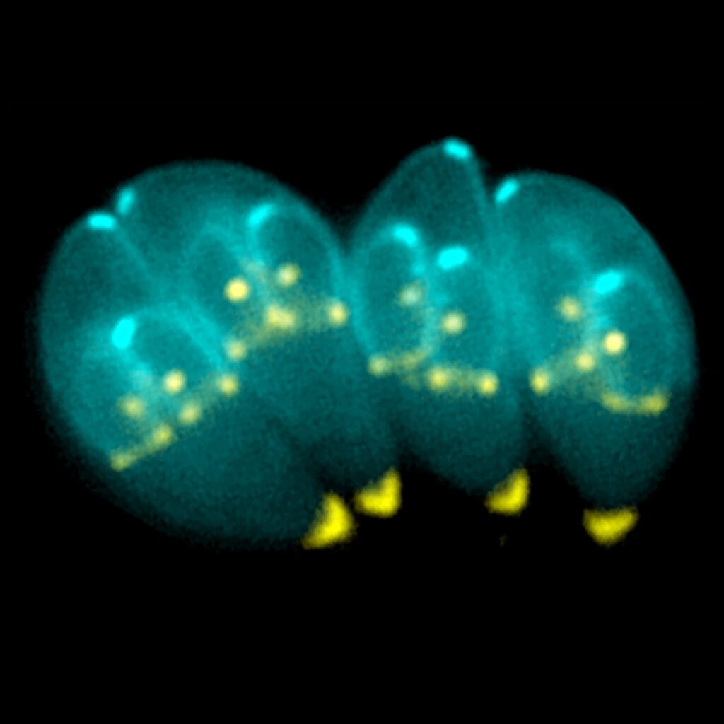 Taquizoítos de Toxoplasma gondii al microscopio