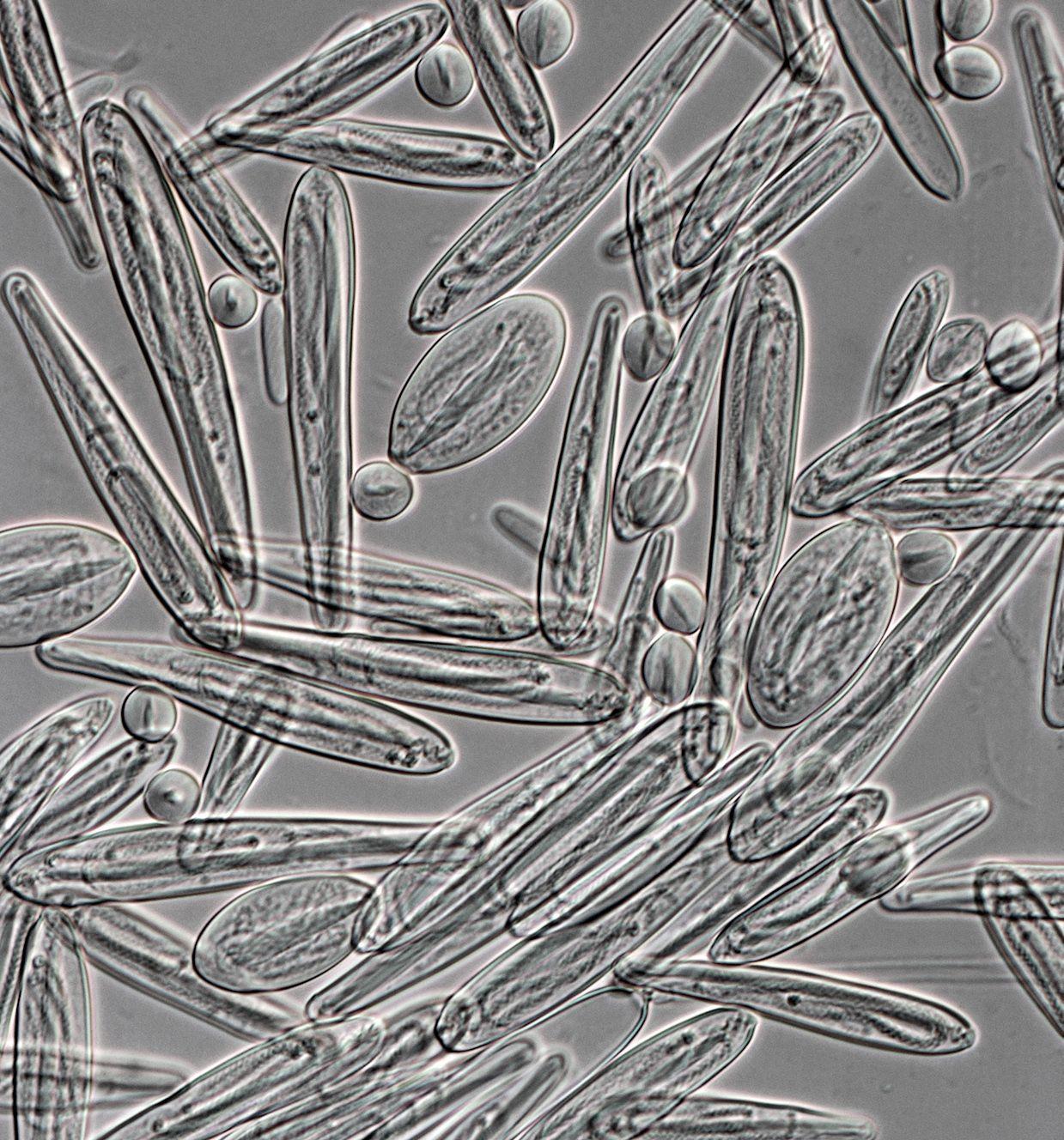 Nematocistos de la avispa marina vistos al microscopio mostrando las células urticantes