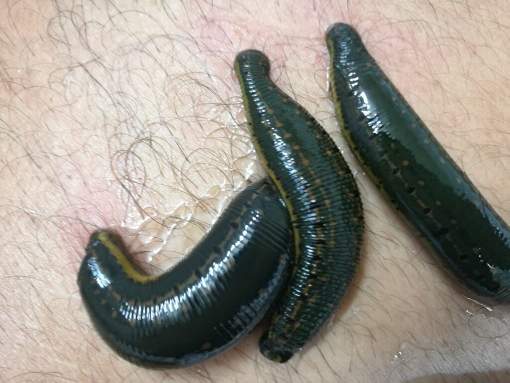 Sanguijuela (Hirudo medicinalis)